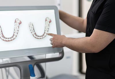 3D digital smile simulation used to treat patients at North Atlanta Family Dentistry