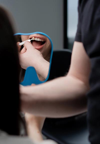 dental veneers Johns Creek, GA